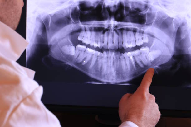 Best Pediatric Emergency Dentist in Clifton Forge, VA
