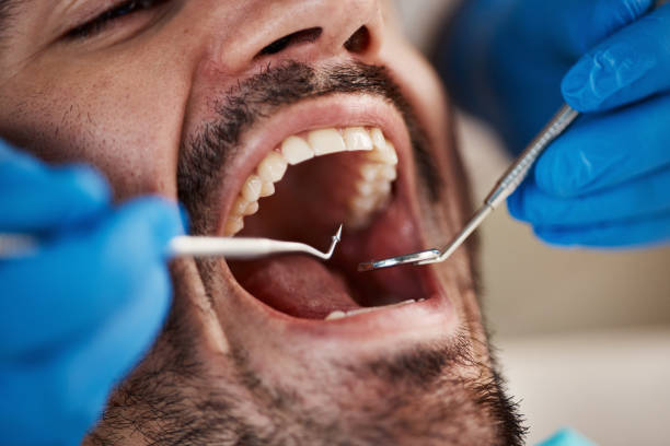 Best Emergency Broken Tooth Repair in Clifton Forge, VA