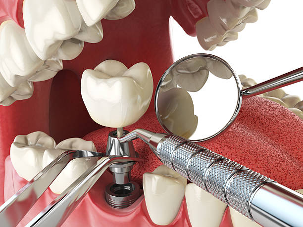 Best Walk-In Emergency Dentist in Clifton Forge, VA